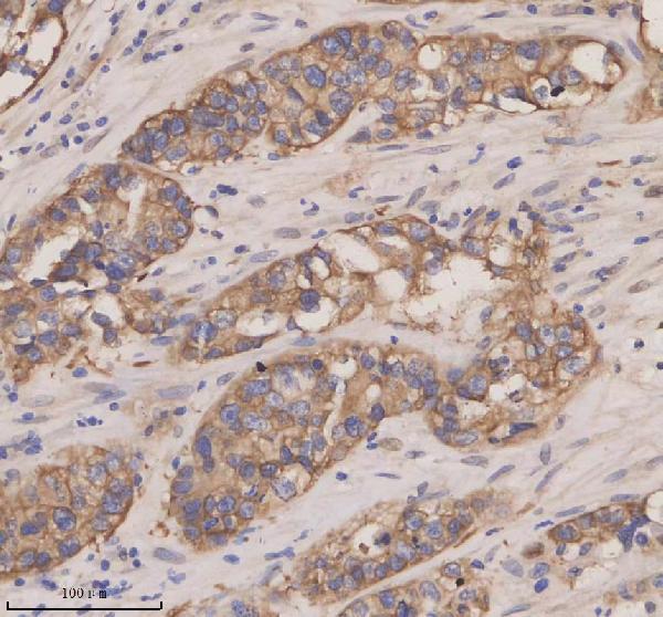  IHC analysis of BCA1/CXCL13 using anti-BCA1/CXCL13 antibody (A02678-1)