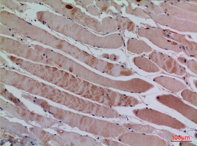 Immunohistochemical analysis of paraffin-embedded human-muscle, antibody was diluted at 1:100