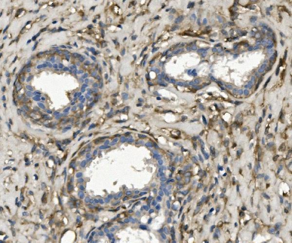a02681 1 myh10 primary antibodies ihc testing 3