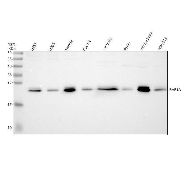 Western blot analysis of RAB1A using anti-RAB1A antibody (A02682-1)