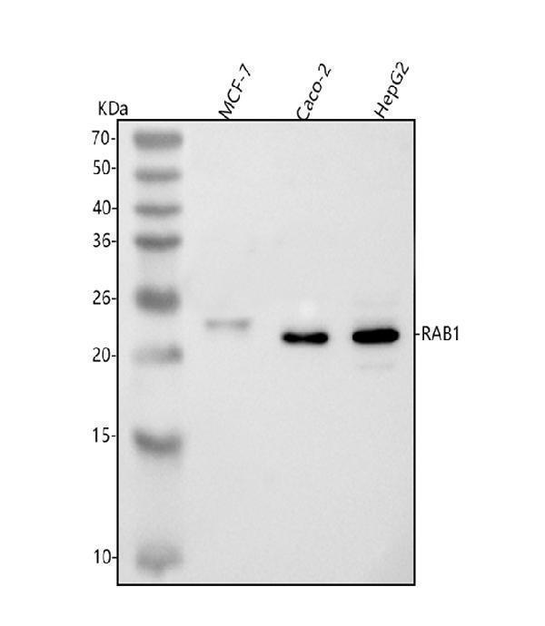  Western blot analysis of RAB1A using anti-RAB1A antibody (A02682-2)