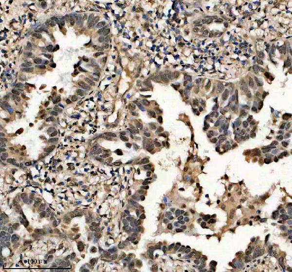 IHC analysis of DCPS using anti-DCPS antibody (A02684-1)