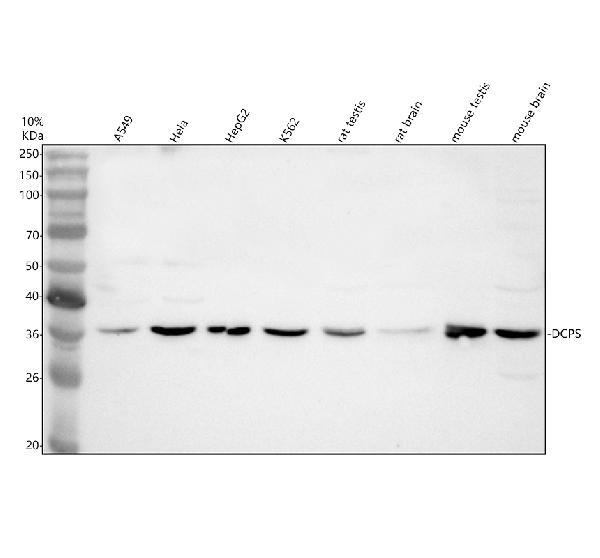 Western blot analysis of DCPS using anti-DCPS antibody (A02684-1)