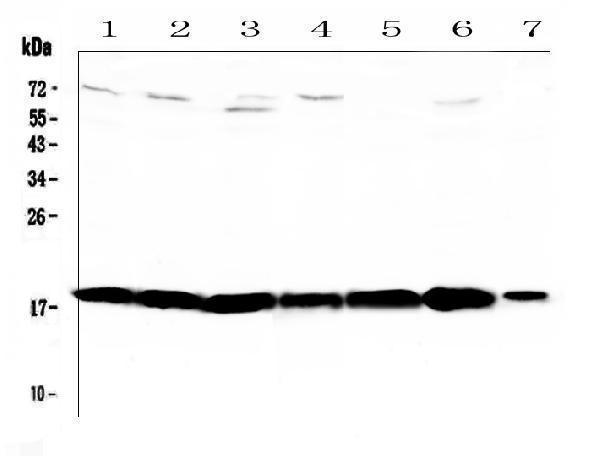  Western blot analysis of HE4 using anti-HE4 antibody (A02685-3)