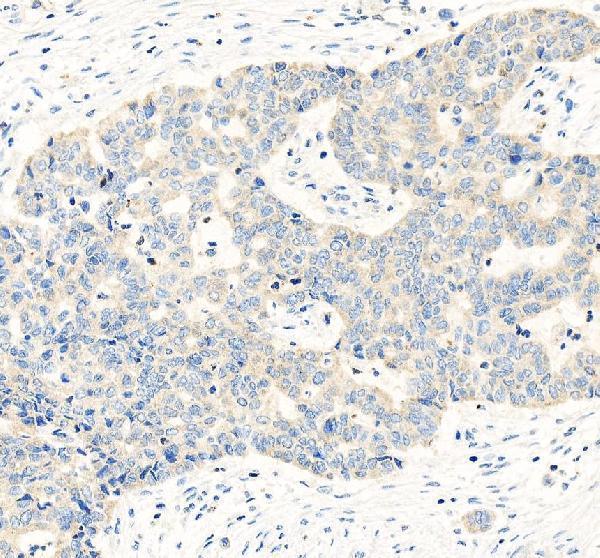 a02685 4 wfdc2 primary antibodies ihc testing 5