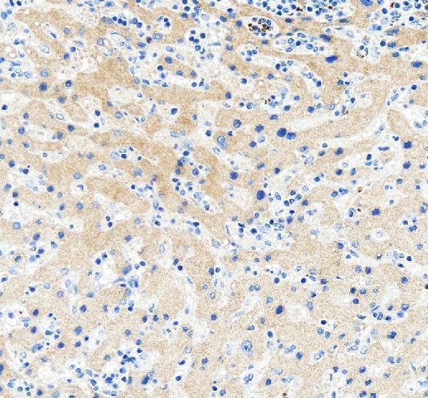a02685 4 wfdc2 primary antibodies ihc testing 6