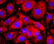 ICC staining HE4 in SKOV-3 cells (red)