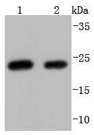 Western blot analysis of HE4 on different lysates using anti-HE4 antibody at 1/1,000 dilution