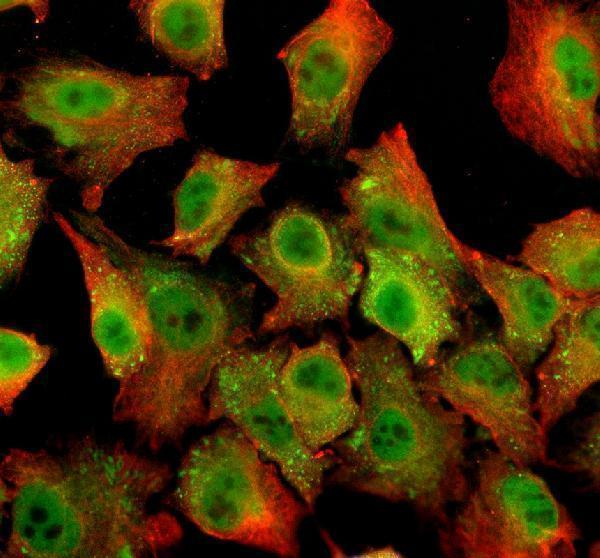 a02686 3 hpgd primary antibodies if testing 2