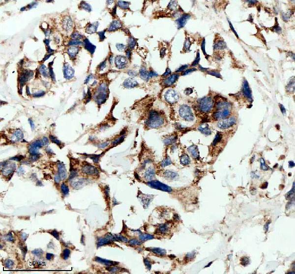 IHC analysis of HPGD using anti-HPGD antibody (A02686-3)