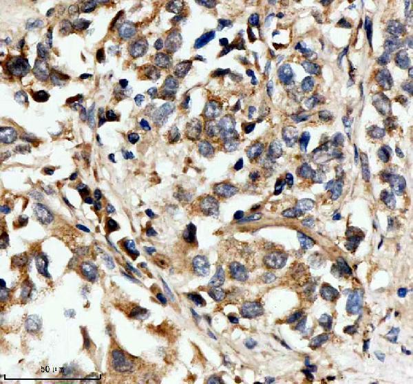 IHC analysis of HPGD using anti-HPGD antibody (A02686-3)