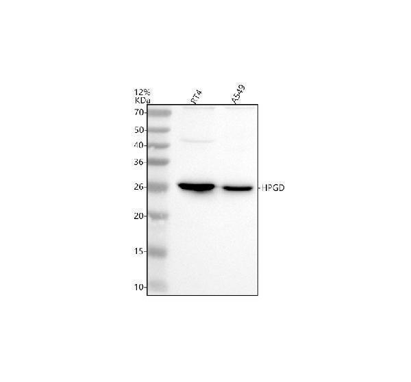 Western blot analysis of HPGD using anti-HPGD antibody (A02686-3)