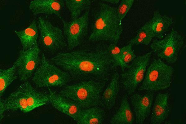 a02687 1 smarca5 primary antibodies if testing 12