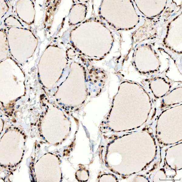 a02687 1 smarca5 primary antibodies ihc testing 10