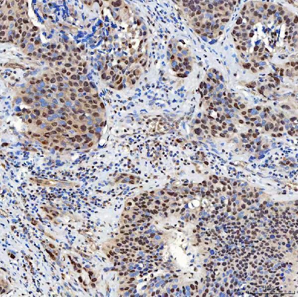 a02687 1 smarca5 primary antibodies ihc testing 11