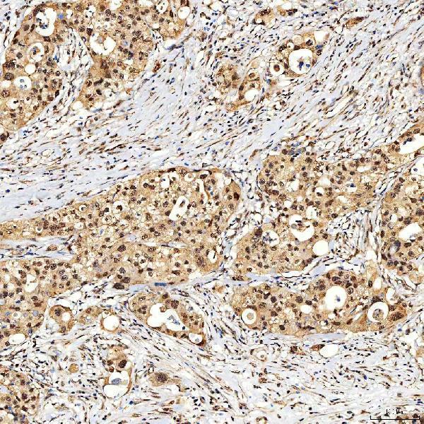  IHC analysis of SNF2H/SMARCA5 using anti-SNF2H/SMARCA5 antibody (A02687-1)