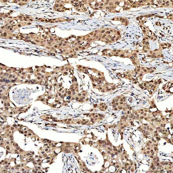  IHC analysis of SNF2H/SMARCA5 using anti-SNF2H/SMARCA5 antibody (A02687-1)