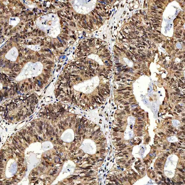 a02687 1 smarca5 primary antibodies ihc testing 5