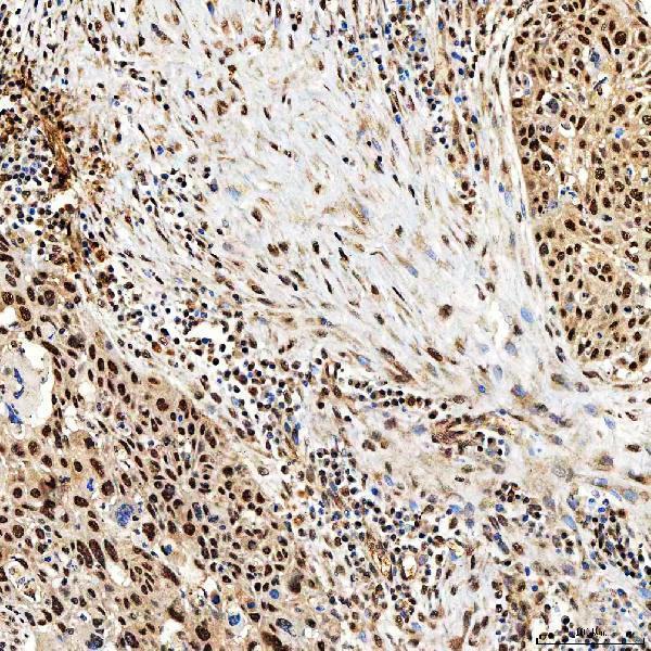 a02687 1 smarca5 primary antibodies ihc testing 6