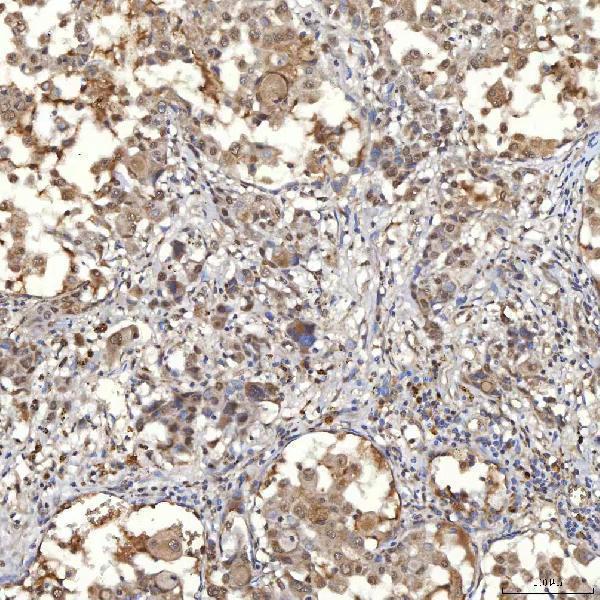a02687 1 smarca5 primary antibodies ihc testing 7