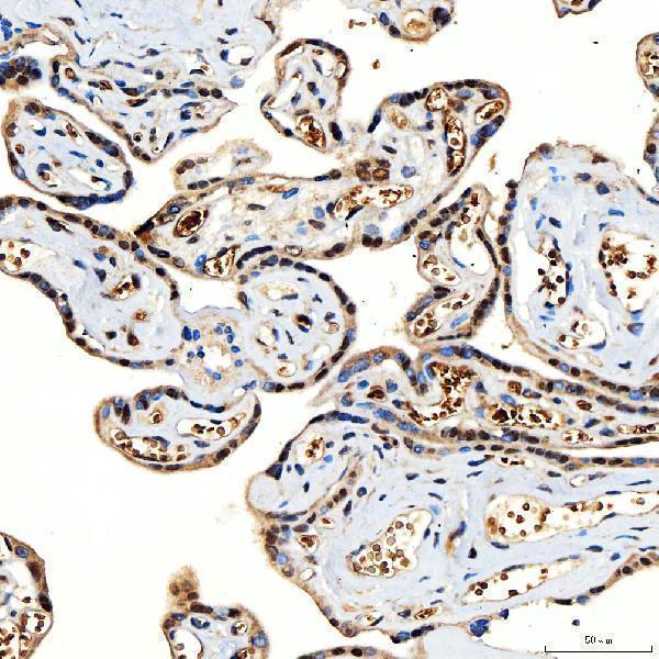 a02687 1 smarca5 primary antibodies ihc testing 8