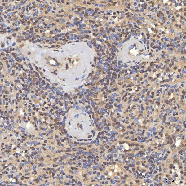 a02687 1 smarca5 primary antibodies ihc testing 9