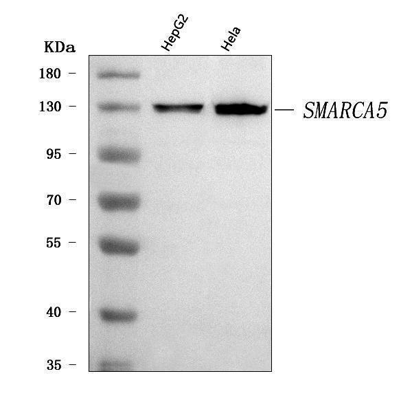  Western blot analysis of SNF2H/SMARCA5 using anti-SNF2H/SMARCA5 antibody (A02687-1)