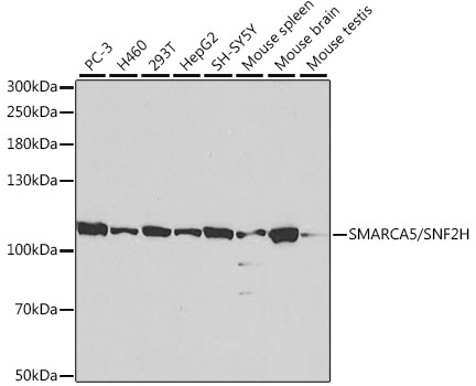 a02687 smarca5 primary antiboties wb testing 1