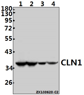 Western blot (WB) analysis of CLN1 (I65) pAb at 1:1000 dilution
Lane1:A549 whole cell lysate(40ug)
Lane2:HepG2 whole cell lysate(40ug)
Lane3:The Brain tissue lysate of Mouse(40ug)
Lane4:The Spleen tissue lysate of Rat(40ug)