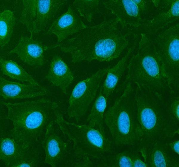 a02691 2 cyp26b1 primary antibodies if testing 1