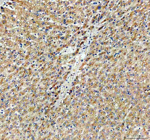 IHC analysis of CYP26B1 using anti-CYP26B1 antibody (A02691-2)
