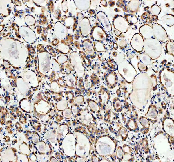 IHC analysis of CYP26B1 using anti-CYP26B1 antibody (A02691-2)