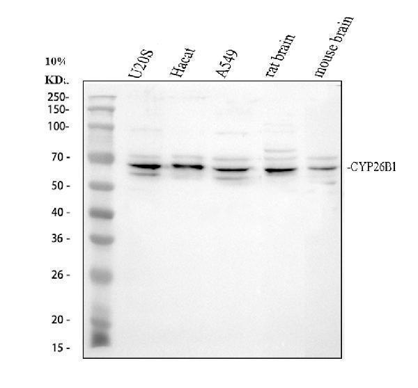 Western blot analysis of CYP26B1 using anti-CYP26B1 antibody (A02691-2)