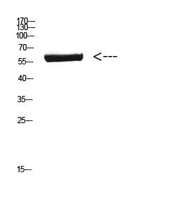 a02691 cyp26b1 primary antibodies wb testing 1