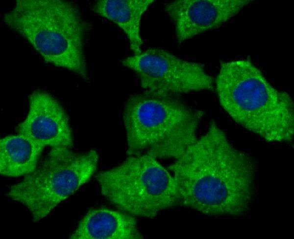 a02692 1 snx1 primary antiboties icc testing 2