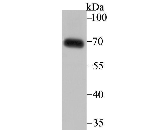 a02692 1 snx1 primary antiboties wb testing 1