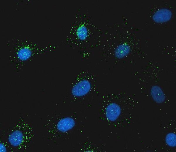 a02692 2 snx1 primary antibodies if testing 5