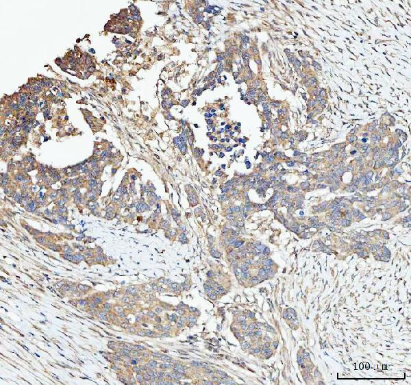 a02692 2 snx1 primary antibodies ihc testing 2