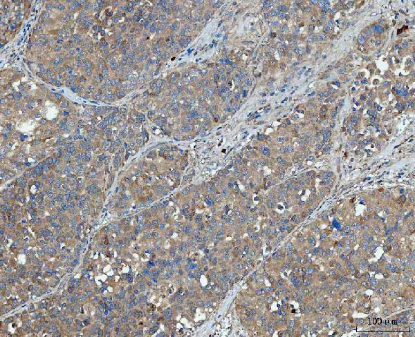 a02692 2 snx1 primary antibodies ihc testing 3