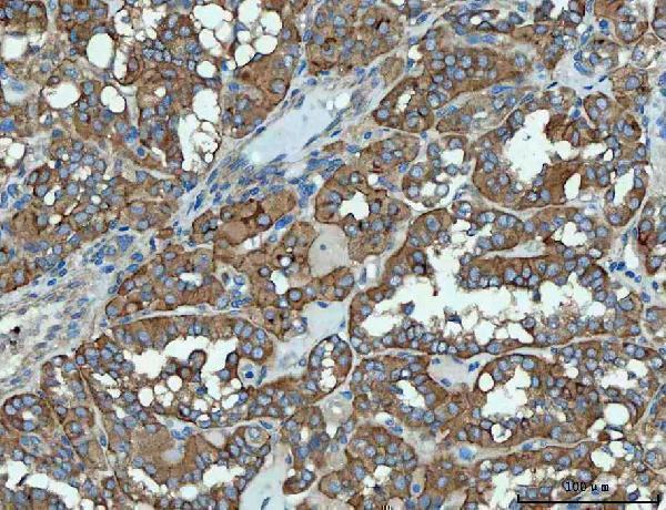a02692 2 snx1 primary antibodies ihc testing 4