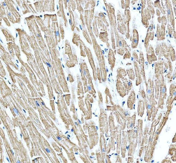 IHC analysis of MYH3 using anti-MYH3 antibody (A02697-1)