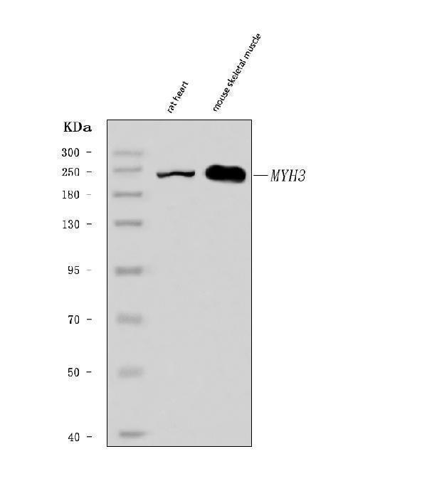  Western blot analysis of heavy chain Myosin/MYH3 using anti-heavy chain Myosin/MYH3 antibody (A02697-2)