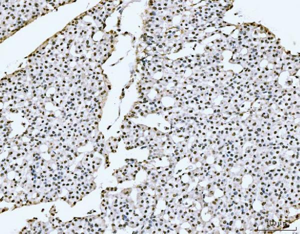 a02698 1 sub1 primary antibodies ihc testing 5
