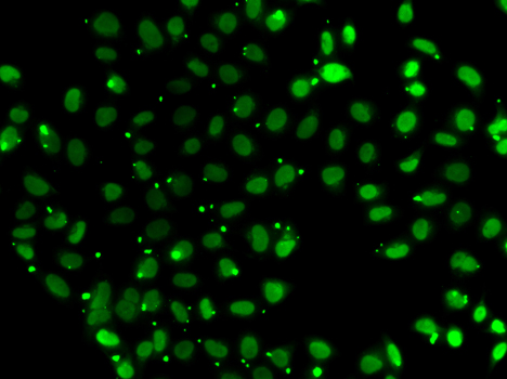 a02698 sub1 primary antiboties if testing 2