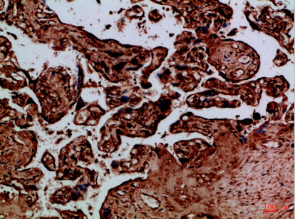 Immunohistochemistry validation of NAIP using Anti-NAIP Antibody (A02699-1)