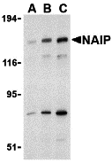 Western blot analysis of NAIP in human tonsil tissue lysate with NAIP antibody at 1 μg/mL