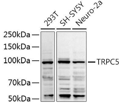 a02701 1 trpc5 primary antiboties wb testing 1