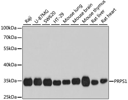 Western blot analysis of extracts of various cell lines, using PRPS1 antibody  at 1:1000 dilution