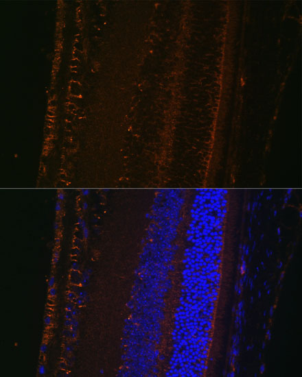 Immunofluorescence analysis of mouse eye using LOXL1 Polyclonal Antibody  at dilution of 1:100 