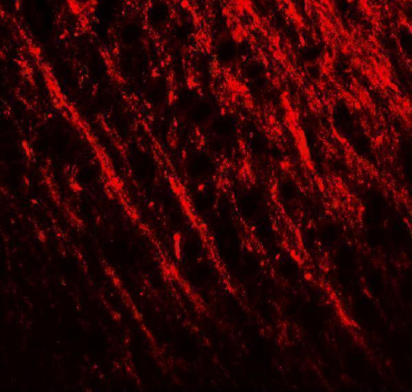 Immunofluorescence of PRRT2 in rat brain tissue with PRRT2 antibody at 20 μg/ml